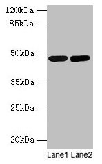 SSB / La Antibody - Western blot All lanes: Lupus La protein antibody at 2µg/ml Lane 1: Mouse liver tissue Lane 2: Mouse brain tissue Secondary Goat polyclonal to rabbit IgG at 1/10000 dilution Predicted band size: 47 kDa Observed band size: 47 kDa