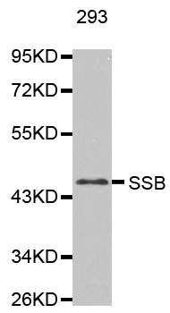 SSB / La Antibody - Western blot analysis of extracts of 293 cells.