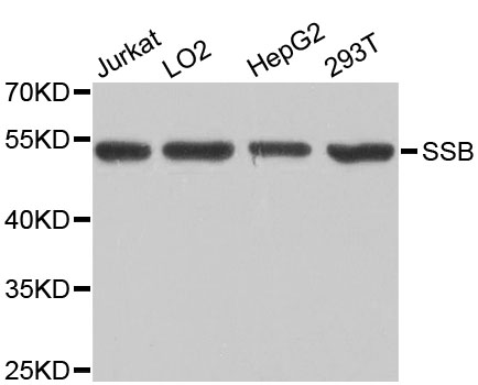 SSB / La Antibody - Western blot analysis of extracts of various cell lines, using SSB antibody at 1:1000 dilution. The secondary antibody used was an HRP Goat Anti-Rabbit IgG (H+L) at 1:10000 dilution. Lysates were loaded 25ug per lane and 3% nonfat dry milk in TBST was used for blocking. An ECL Kit was used for detection and the exposure time was 1s.