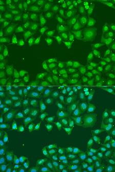 SSB / La Antibody - Immunofluorescence analysis of U2OS cells using SSB antibodyat dilution of 1:100. Blue: DAPI for nuclear staining.