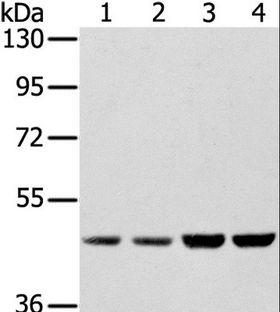 SSB / La Antibody - Western blot analysis of HeLa, Raji, 231 and K562 cell, using SSB Polyclonal Antibody at dilution of 1:400.
