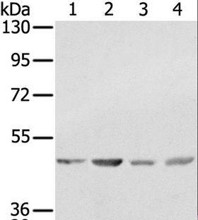 SSB / La Antibody - Western blot analysis of K562, 231, Raji and HeLa cell, using SSB Polyclonal Antibody at dilution of 1:400.