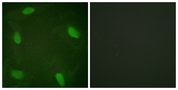 SSB / La Antibody - Immunofluorescence analysis of HeLa cells treated with Forskolin 40nM 30', using SSB (Phospho-Ser366) Antibody. The picture on the right is blocked with the phospho peptide.