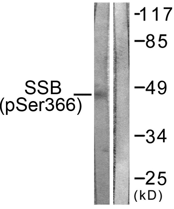 SSB / La Antibody - Western blot analysis of lysates from 293 cells, using SSB (Phospho-Ser366) Antibody. The lane on the right is blocked with the phospho peptide.