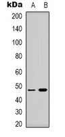SSB / La Antibody - Western blot analysis of Lupus La (pS366) expression in HEK293T (A); MCF7 (B) whole cell lysates.