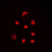SSB / La Antibody - Immunofluorescent analysis of Lupus La (pS366) staining in HeLa cells. Formalin-fixed cells were permeabilized with 0.1% Triton X-100 in TBS for 5-10 minutes and blocked with 3% BSA-PBS for 30 minutes at room temperature. Cells were probed with the primary antibody in 3% BSA-PBS and incubated overnight at 4 deg C in a humidified chamber. Cells were washed with PBST and incubated with a DyLight 594-conjugated secondary antibody (red) in PBS at room temperature in the dark. DAPI was used to stain the cell nuclei (blue).