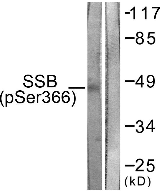 SSB / La Antibody - Western blot analysis of extracts from 293 cells, using SSB (Phospho-Ser366) antibody.