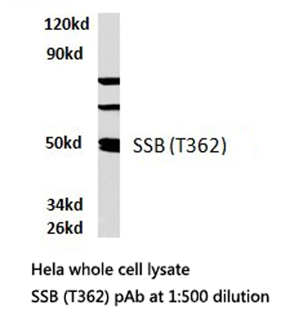 SSB / La Antibody - Western blot of SSB (T362)pAb in extracts from HeLa cells.