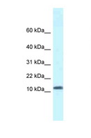 SSBP1 / mtSSB Antibody - SSBP1 antibody Western blot of Fetal Kidney lysate. Antibody concentration 1 ug/ml.  This image was taken for the unconjugated form of this product. Other forms have not been tested.