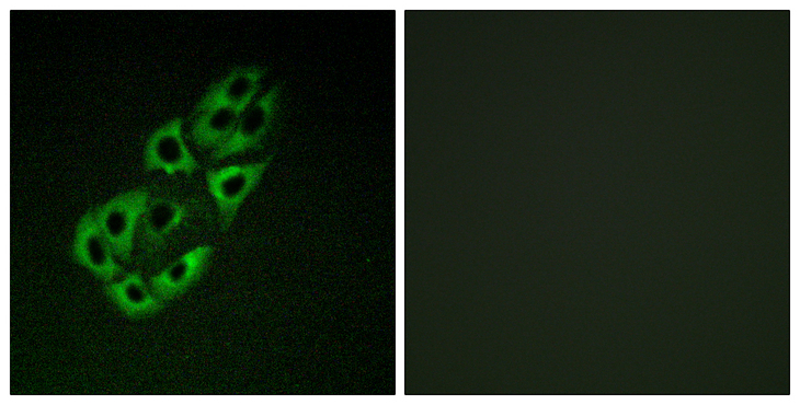 SSBP1 / mtSSB Antibody - Immunofluorescence analysis of A549 cells, using MtSSB Antibody. The picture on the right is blocked with the synthesized peptide.