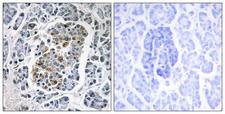 SSBP1 / mtSSB Antibody - Immunohistochemistry analysis of paraffin-embedded human pancreas tissue, using MtSSB Antibody. The picture on the right is blocked with the synthesized peptide.