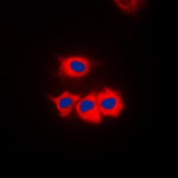 SSBP1 / mtSSB Antibody - Immunofluorescent analysis of SSBP1 staining in HeLa cells. Formalin-fixed cells were permeabilized with 0.1% Triton X-100 in TBS for 5-10 minutes and blocked with 3% BSA-PBS for 30 minutes at room temperature. Cells were probed with the primary antibody in 3% BSA-PBS and incubated overnight at 4 C in a humidified chamber. Cells were washed with PBST and incubated with a DyLight 594-conjugated secondary antibody (red) in PBS at room temperature in the dark. DAPI was used to stain the cell nuclei (blue).