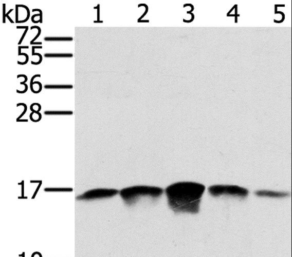 SSBP1 / mtSSB Antibody - Western blot analysis of PC3, A549, K562, A375 and HeLa cell, using SSBP1 Polyclonal Antibody at dilution of 1:400.
