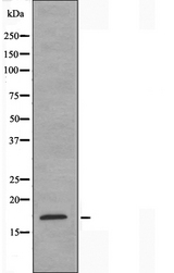 SSBP1 / mtSSB Antibody - Western blot analysis of extracts of HeLa cells using MtSSB antibody.