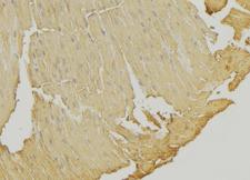 SSBP1 / mtSSB Antibody - 1:100 staining mouse muscle tissue by IHC-P. The sample was formaldehyde fixed and a heat mediated antigen retrieval step in citrate buffer was performed. The sample was then blocked and incubated with the antibody for 1.5 hours at 22°C. An HRP conjugated goat anti-rabbit antibody was used as the secondary.