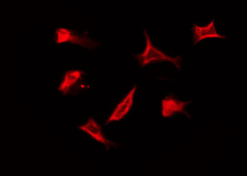 SSBP1 / mtSSB Antibody - Staining HuvEc cells by IF/ICC. The samples were fixed with PFA and permeabilized in 0.1% Triton X-100, then blocked in 10% serum for 45 min at 25°C. The primary antibody was diluted at 1:200 and incubated with the sample for 1 hour at 37°C. An Alexa Fluor 594 conjugated goat anti-rabbit IgG (H+L) Ab, diluted at 1/600, was used as the secondary antibody.