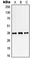 SSBP2 Antibody - Western blot analysis of SSBP2 expression in K562 (A); NIH3T3 (B); rat kidney (C) whole cell lysates.