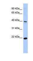 SSBP4 Antibody - SSBP4 antibody Western blot of Fetal Stomach lysate. This image was taken for the unconjugated form of this product. Other forms have not been tested.
