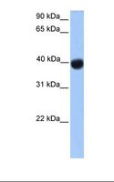 SSBP4 Antibody - Transfected 293T cell lysate. Antibody concentration: 1.0 ug/ml. Gel concentration: 12%.  This image was taken for the unconjugated form of this product. Other forms have not been tested.