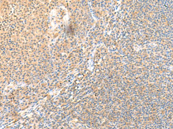 SSC4D / SRCRB4D Antibody - Immunohistochemistry of paraffin-embedded Human tonsil tissue  using SSC4D Polyclonal Antibody at dilution of 1:70(×200)