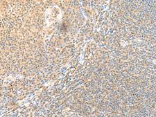 SSC4D / SRCRB4D Antibody - Immunohistochemistry of paraffin-embedded Human tonsil tissue  using SSC4D Polyclonal Antibody at dilution of 1:70(×200)