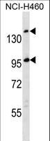 SSC5D Antibody - SSC5D Antibody western blot of NCI-H460 cell line lysates (35 ug/lane). The SSC5D antibody detected the SSC5D protein (arrow).