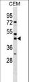 SSDP1 / SSBP3 Antibody - SSBP3 Antibody western blot of CEM cell line lysates (35 ug/lane). The SSBP3 antibody detected the SSBP3 protein (arrow).