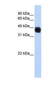 SSDP1 / SSBP3 Antibody - SSBP3 antibody Western blot of MCF7 cell lysate. This image was taken for the unconjugated form of this product. Other forms have not been tested.