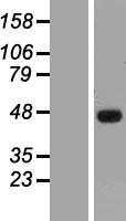 SSDP1 / SSBP3 Protein - Western validation with an anti-DDK antibody * L: Control HEK293 lysate R: Over-expression lysate