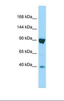 SSFA2 Antibody - Western blot of Human HT1080. SSFA2 antibody dilution 1.0 ug/ml.  This image was taken for the unconjugated form of this product. Other forms have not been tested.
