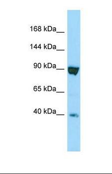 SSFA2 Antibody - Western blot of Human HT1080. SSFA2 antibody dilution 1.0 ug/ml.  This image was taken for the unconjugated form of this product. Other forms have not been tested.