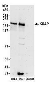 SSFA2 Antibody - Detection of human KRAP by western blot. Samples: Whole cell lysate (50 µg) from HeLa, HEK293T, and Jurkat cells prepared using NETN lysis buffer. Antibodies: Affinity purified rabbit anti-KRAP antibody used for WB at 0.1 µg/ml. Detection: Chemiluminescence with an exposure time of 3 minutes.