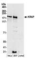 SSFA2 Antibody - Detection of human KRAP by western blot. Samples: Whole cell lysate (50 µg) from HeLa, HEK293T, and Jurkat cells prepared using NETN lysis buffer. Antibodies: Affinity purified rabbit anti-KRAP antibody used for WB at 0.1 µg/ml. Detection: Chemiluminescence with an exposure time of 3 minutes.