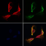 SSFA2 Antibody - Staining HeLa cells by IF/ICC. The samples were fixed with PFA and permeabilized in 0.1% Triton X-100, then blocked in 10% serum for 45 min at 25°C. Samples were then incubated with primary Ab(1:200) and mouse anti-beta tubulin Ab(1:200) for 1 hour at 37°C. An AlexaFluor594 conjugated goat anti-rabbit IgG(H+L) Ab(1:200 Red) and an AlexaFluor488 conjugated goat anti-mouse IgG(H+L) Ab(1:600 Green) were used as the secondary antibod