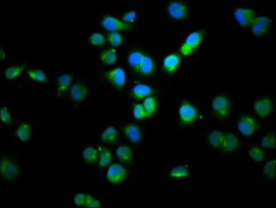 SSH1 Antibody - Immunofluorescence staining of Hela cells diluted at 1:100, counter-stained with DAPI. The cells were fixed in 4% formaldehyde, permeabilized using 0.2% Triton X-100 and blocked in 10% normal Goat Serum. The cells were then incubated with the antibody overnight at 4°C.The Secondary antibody was Alexa Fluor 488-congugated AffiniPure Goat Anti-Rabbit IgG (H+L).