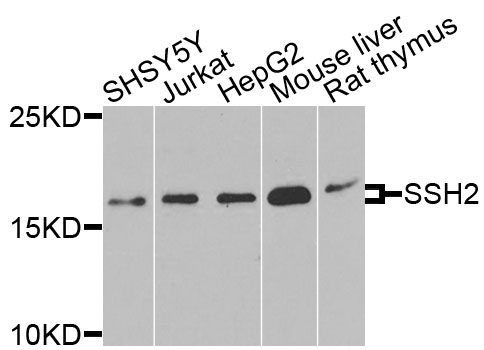 SSH2 Antibody - Western blot blot of extracts of various cells, using SSH2 antibody.