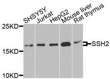 SSH2 Antibody - Western blot blot of extracts of various cells, using SSH2 antibody.