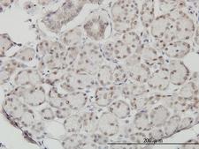 SSH3 Antibody - Immunoperoxidase of monoclonal antibody to SSH3 on formalin-fixed paraffin-embedded human salivary gland. [antibody concentration 1 ~10 ug/ml].