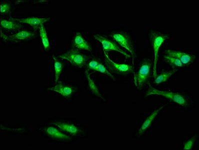 SSH3 Antibody - Immunofluorescence staining of Hela cells at a dilution of 1:133, counter-stained with DAPI. The cells were fixed in 4% formaldehyde, permeabilized using 0.2% Triton X-100 and blocked in 10% normal Goat Serum. The cells were then incubated with the antibody overnight at 4 °C.The secondary antibody was Alexa Fluor 488-congugated AffiniPure Goat Anti-Rabbit IgG (H+L) .