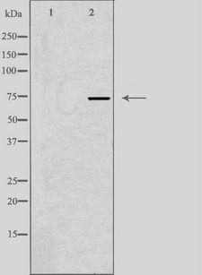 SSH3 Antibody - Western blot analysis of extracts of HuvEc cells using SSH3 antibody. The lane on the left is treated with the antigen-specific peptide.