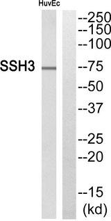 SSH3 Antibody - Western blot analysis of extracts from HuvEc cells, using SSH3 antibody.