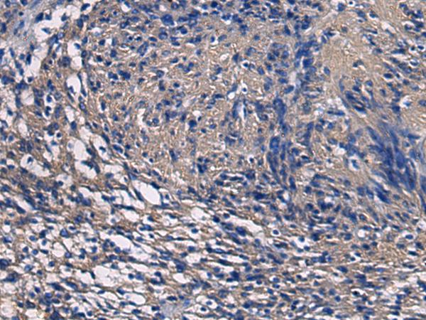 SSH3 Antibody - Immunohistochemistry of paraffin-embedded Human brain tissue  using SSH3 Polyclonal Antibody at dilution of 1:55(×200)