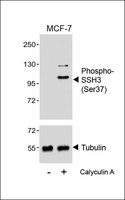 SSH3 Antibody - Western blot analysis of lysates from MCF-7 cell line, untreated or treated with Calyculin A, 100nM, using (upper) or Tubulin (lower).
