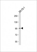 SSH3 Antibody - Anti-SSH3 (Ser37) Antibody at 1:2000 dilution + ZR-75-1 whole cell lysate Lysates/proteins at 20 µg per lane. Secondary Goat Anti-Rabbit IgG, (H+L), Peroxidase conjugated at 1/10000 dilution. Predicted band size: 73 kDa Blocking/Dilution buffer: 5% NFDM/TBST.