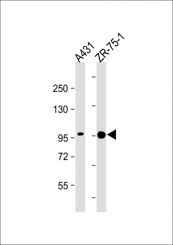 SSH3 Antibody - All lanes: Anti-Phospho-SSH3 (Ser37) Antibody: Ctrl at 1:2000 dilution Lane 1: A431 whole cell lysate Lane 2: ZR-75-1 whole cell lysate Lysates/proteins at 20 µg per lane. Secondary Goat Anti-Rabbit IgG, (H+L), Peroxidase conjugated at 1/10000 dilution. Predicted band size: 73 kDa Blocking/Dilution buffer: 5% NFDM/TBST.