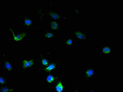 SSMEM1 / C7orf45 Antibody - Immunofluorescent analysis of U251 cells using SSMEM1 Antibody at dilution of 1:100 and Alexa Fluor 488-congugated AffiniPure Goat Anti-Rabbit IgG(H+L)