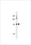 SSNA1 Antibody - SSNA1 Antibody western blot of A2058 cell line lysates (35 ug/lane). The SSNA1 antibody detected the SSNA1 protein (arrow).