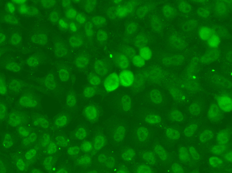 SSNA1 Antibody - Immunofluorescence analysis of A549 cells.