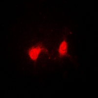 SSNA1 Antibody - Immunofluorescent analysis of SSNA1 staining in A549 cells. Formalin-fixed cells were permeabilized with 0.1% Triton X-100 in TBS for 5-10 minutes and blocked with 3% BSA-PBS for 30 minutes at room temperature. Cells were probed with the primary antibody in 3% BSA-PBS and incubated overnight at 4 deg C in a humidified chamber. Cells were washed with PBST and incubated with a DyLight 594-conjugated secondary antibody (red) in PBS at room temperature in the dark.