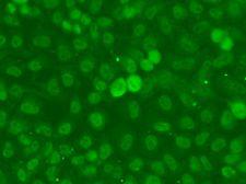 SSNA1 Antibody - Immunofluorescence analysis of A549 cells using SSNA1 antibody.